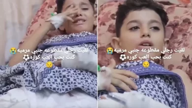 A Palestinian child whose foot was amputated by Israeli bombing of Gaza