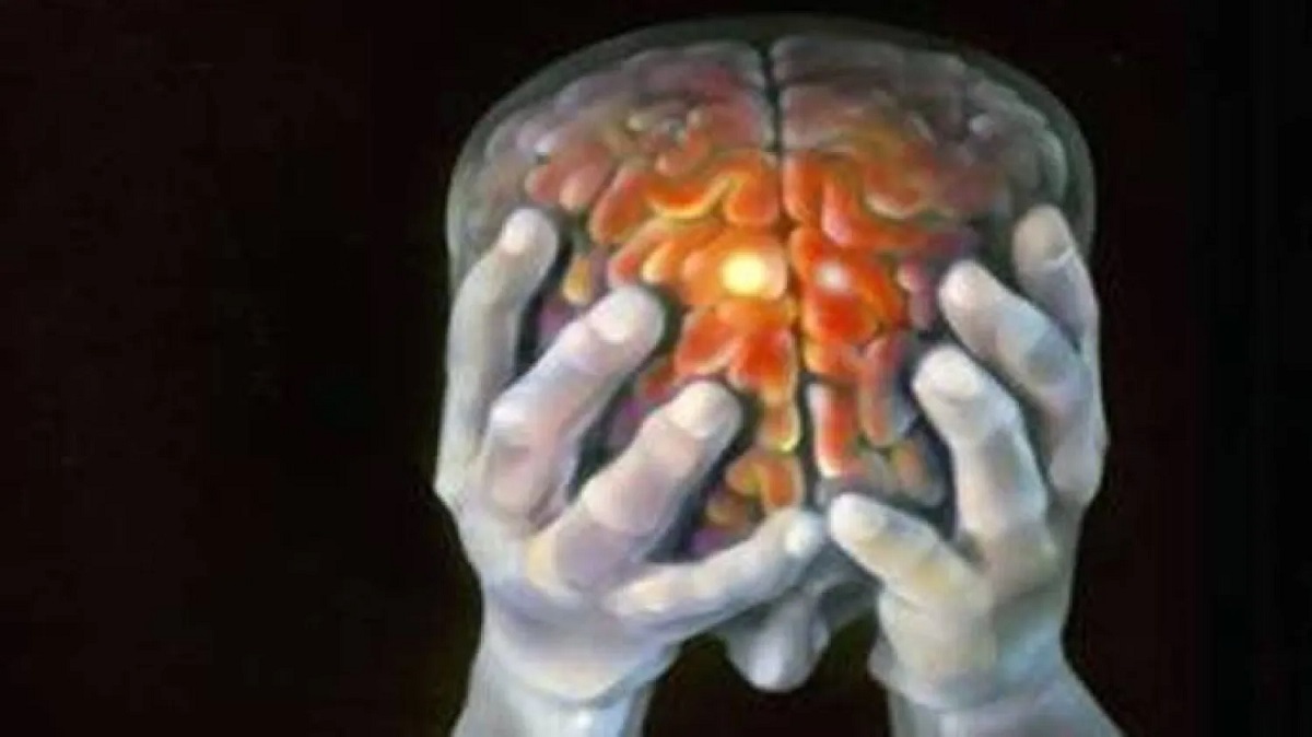 New research shows that transient ischemic attacks (TIAs), often dismissed as minor, can cause serious, lasting effects on memory and cognition.