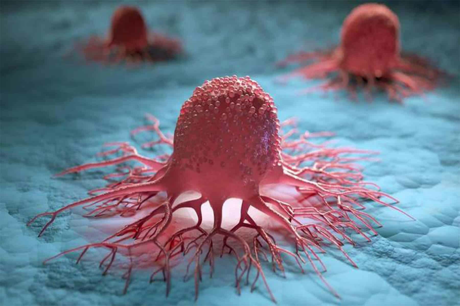 فيروس يهاجم الخلايا السرطانية watanserb.com