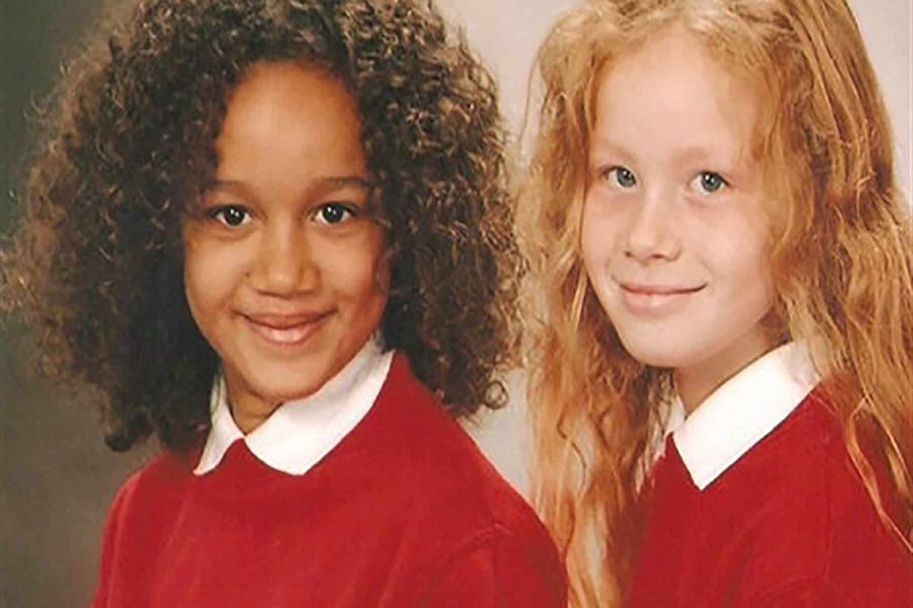 أغرب توأم في العالم watanserb.com