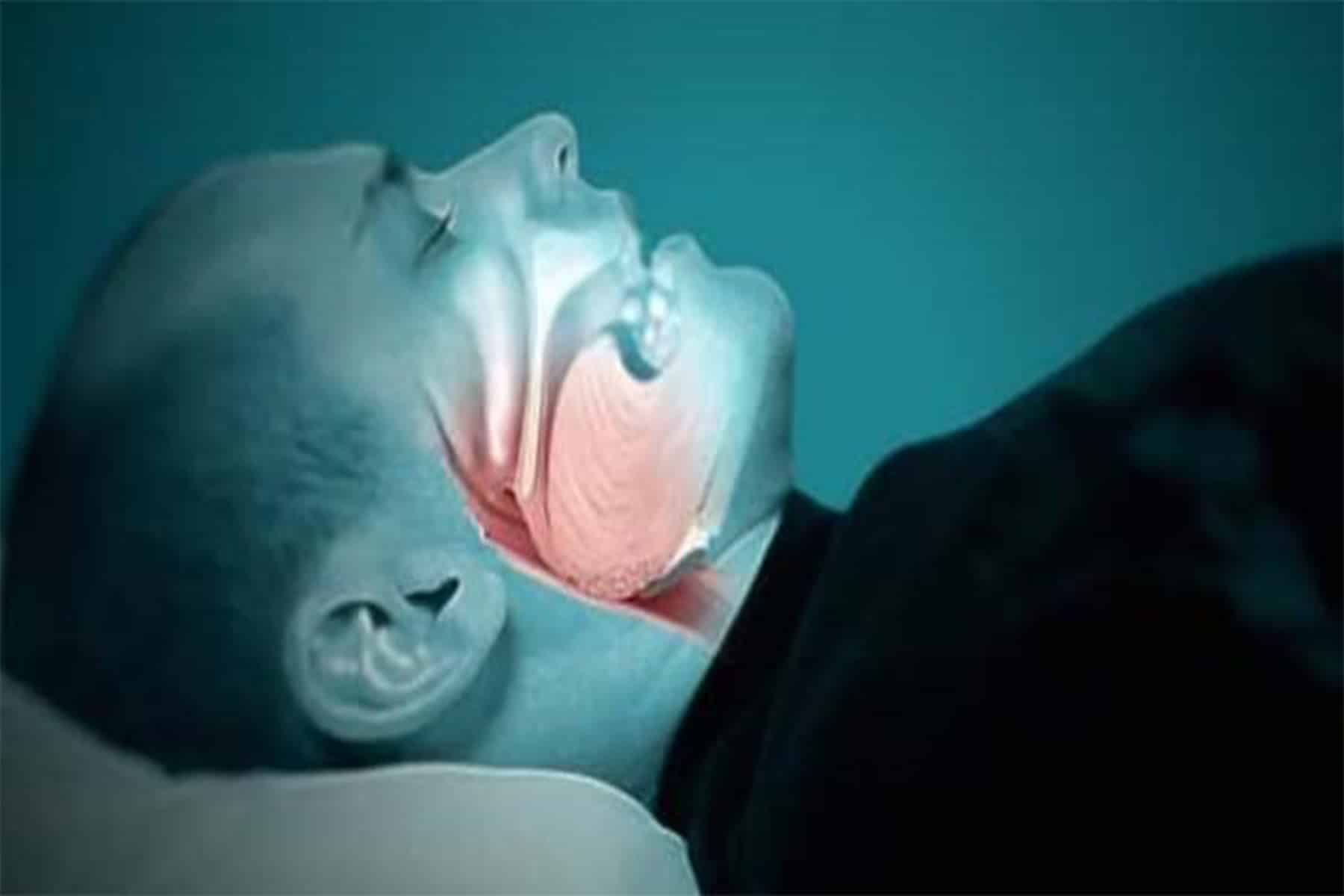 صعوبات التنفس أثناء النوم watanserb.com