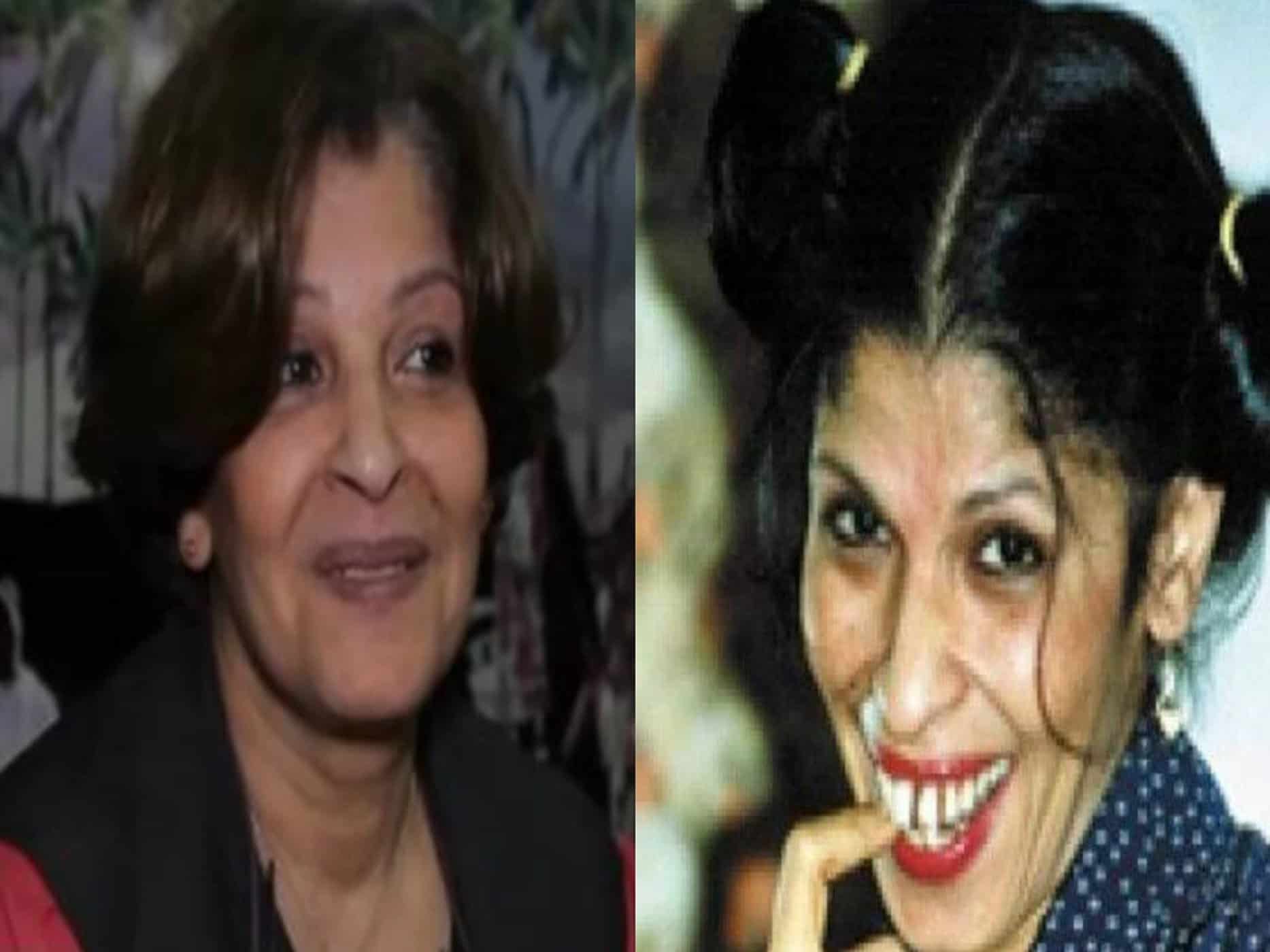 فنانة تجري عمليات تجميل watanserb.com