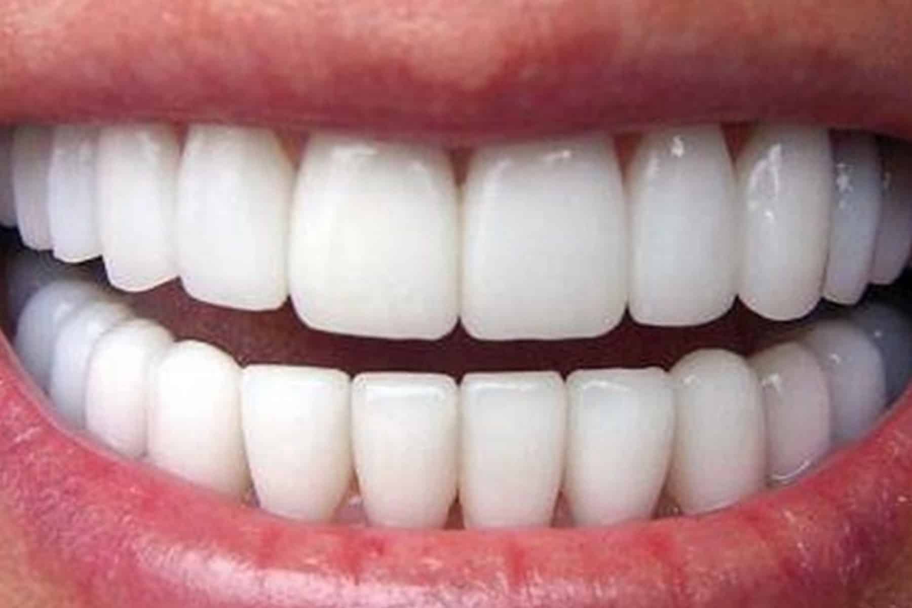 أسنان البشر watanserb.com
