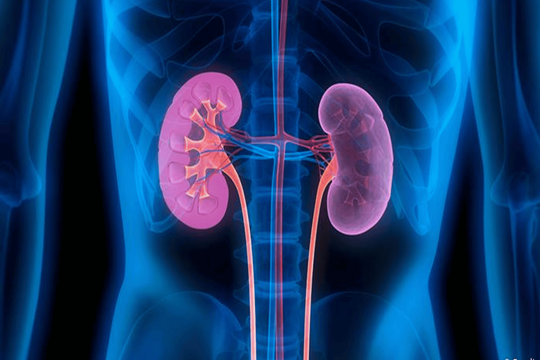 عادات تدّمر الكلى watanserb.com