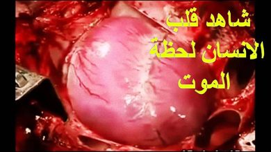 ماذا يحدث في القلب لحظة خروج الروح من الجسد