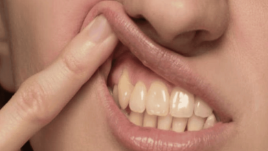 مشكلة اصفرار الأسنان watanserb.com