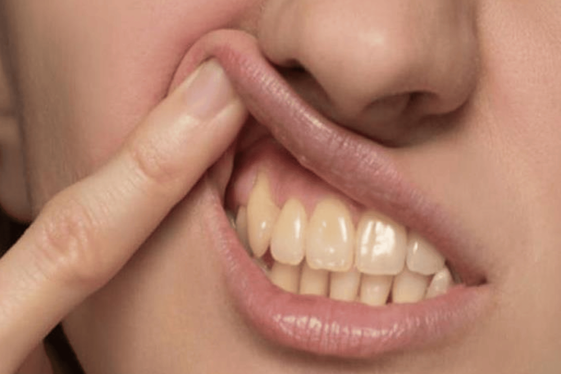 مشكلة اصفرار الأسنان watanserb.com