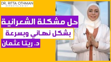 مشكلة الشعر الزائد