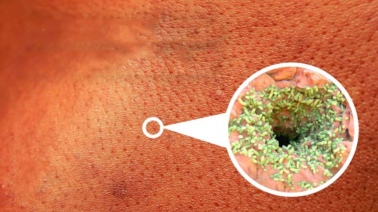 أبرز عشرة أماكن في جسم الإنسان لتكاثر الجراثيم