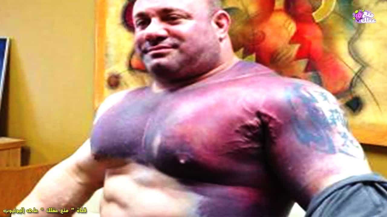 لاعبو كمال أجسام انفجرت عضلاتهم!