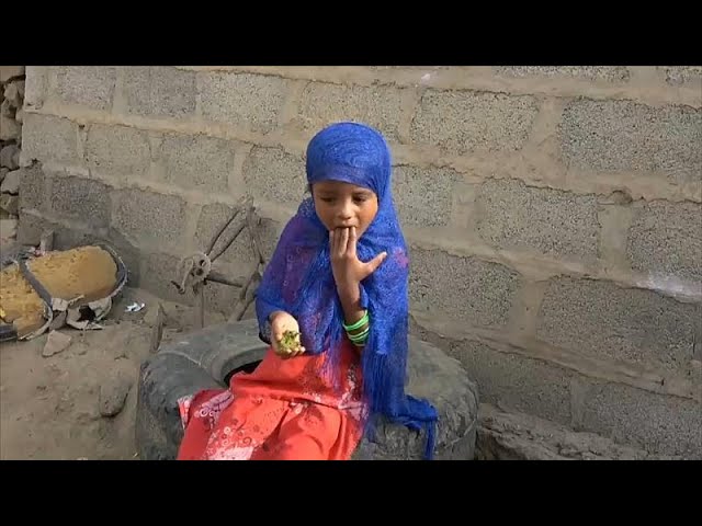 وفاة طفلة يمنية بعد أيام