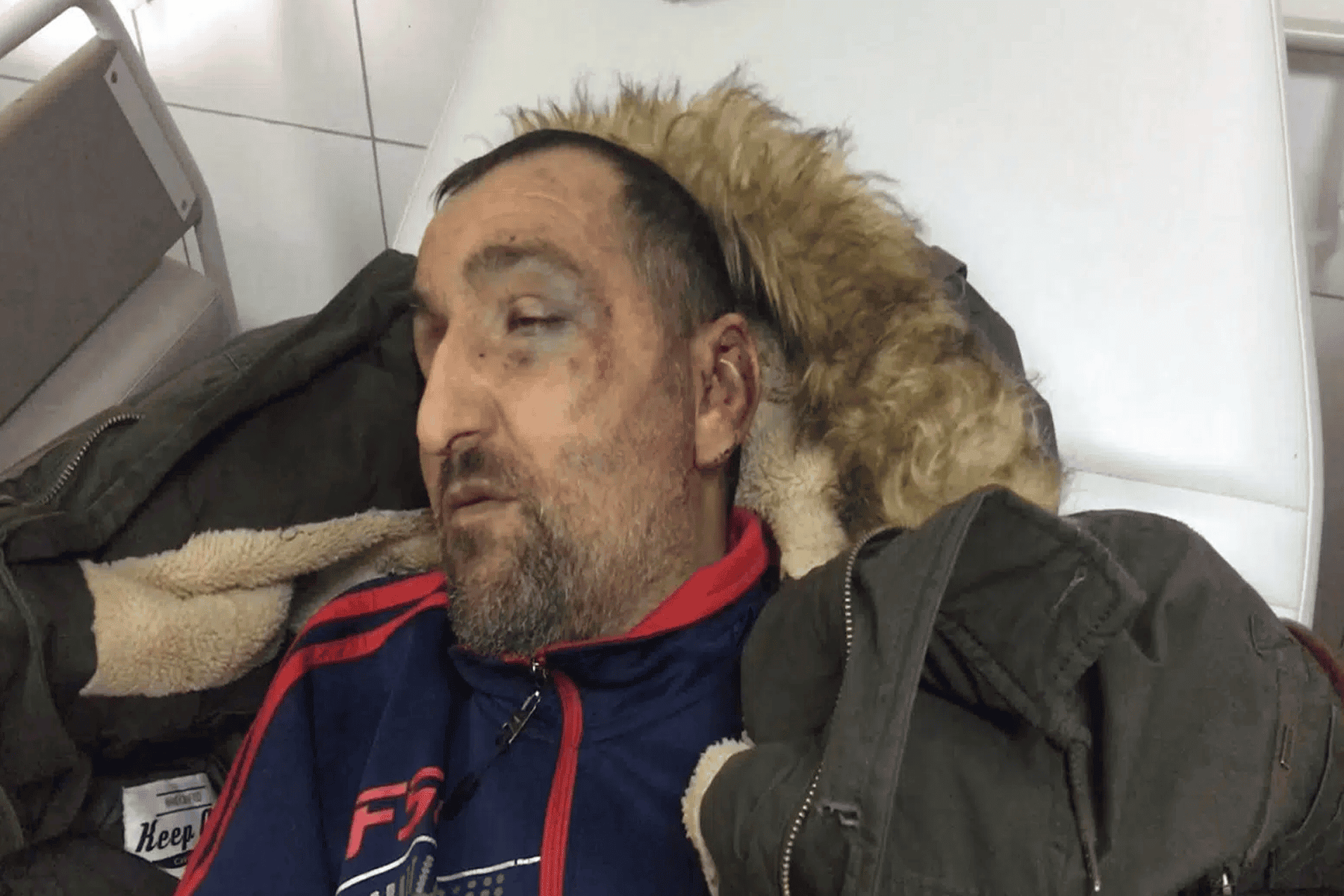 الاحتلال يعتدون على كفيف watanserb.com