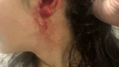 سعودي يقطع اذن اخته watanserb.com