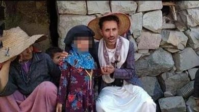 الطفلة اليمنية ليمون ساعدوا ليمون watanserb.com