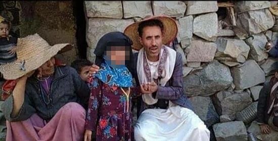 الطفلة اليمنية ليمون ساعدوا ليمون watanserb.com