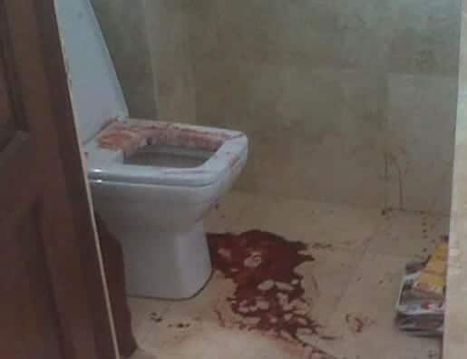 تعذيب خادمة في دبي حتى الموت - تعبيرية- دبي الإمارات جريمة watanserb.com