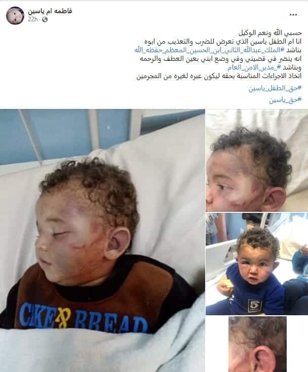 أردني يعذب رضيعه بوحشية يثير الغضب .. ووالدته تستغيث بالملك 1