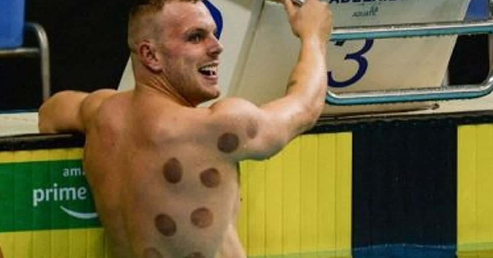 البقع السوداء على أجساد الرياضيين watanserb.com