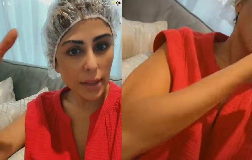 زارا البلوشي تكشف تقشر جسدها بسبب "التان" watanserb.com