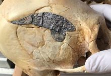 جمجمة مستطيلة ركبت عليها صفيحة معدنية مزروعة جراحيًا تعود إلى حوالي 2000 عام watanserb.com