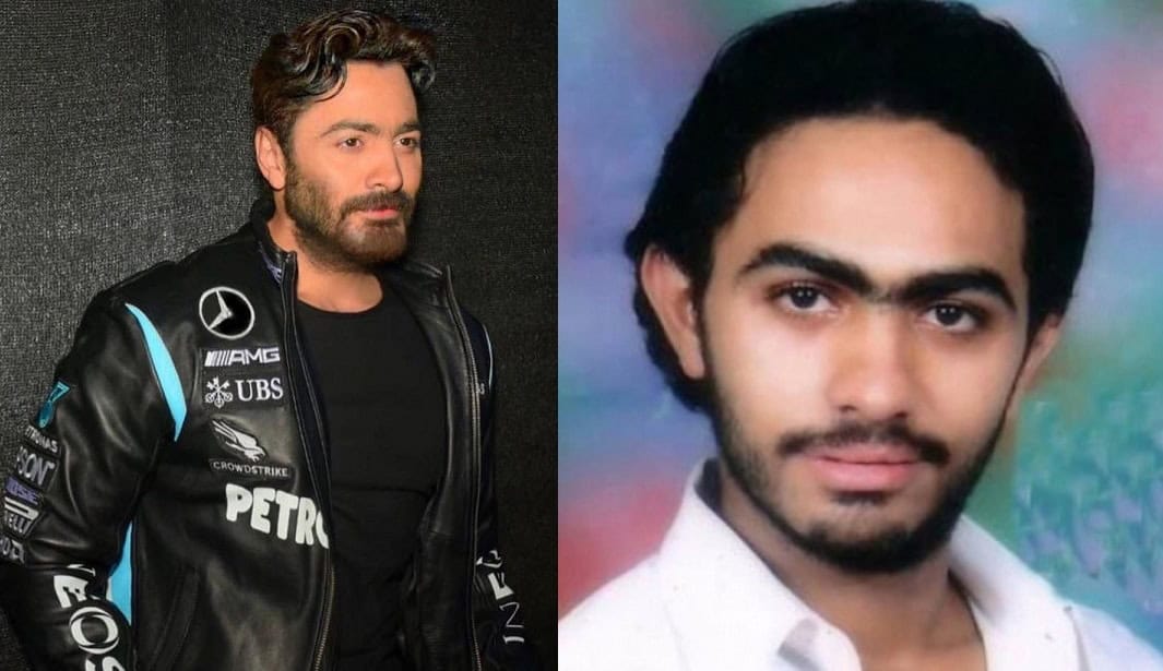 طبيب تجميل يكشف سبب تحول وجه تامر حسني لنسخة من وائل كفوري! watanserb.com