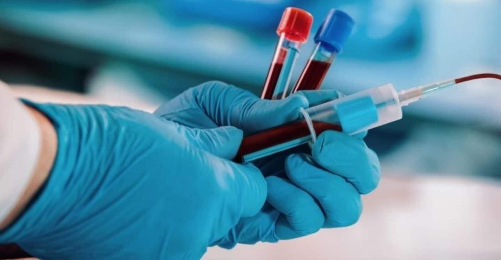 عصابة تخطف رجلاً ليكون عبداً للإتجار بالدم watanserb.com