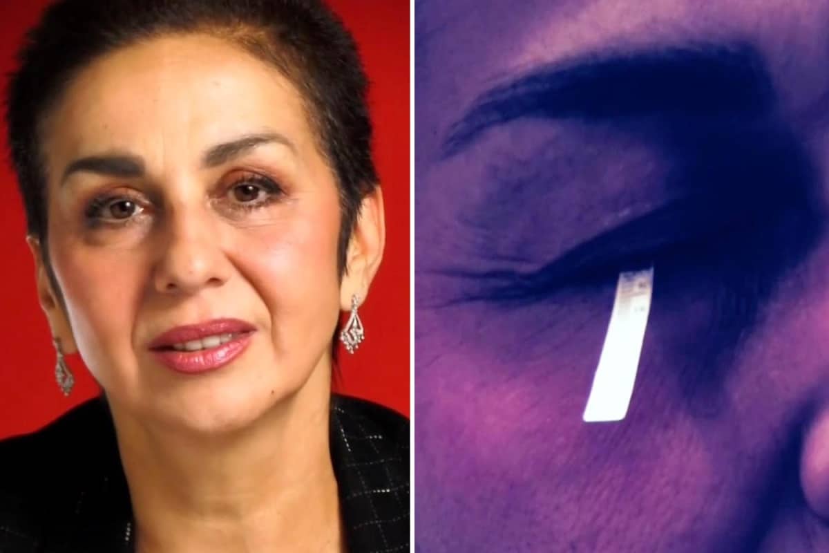 امرأة لم تستطع البكاء لمدة 30 عامًا وكادت تفقد بصرها watanserb.com serbapp.com