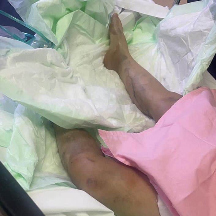 سعودي يحرق زوجته