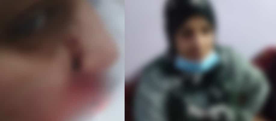 مصر.. كاميرات مرقبة توثق لحظة تمزيق وجه سيدة على يد طليقها غدراً (فيديو) watanserb.com
