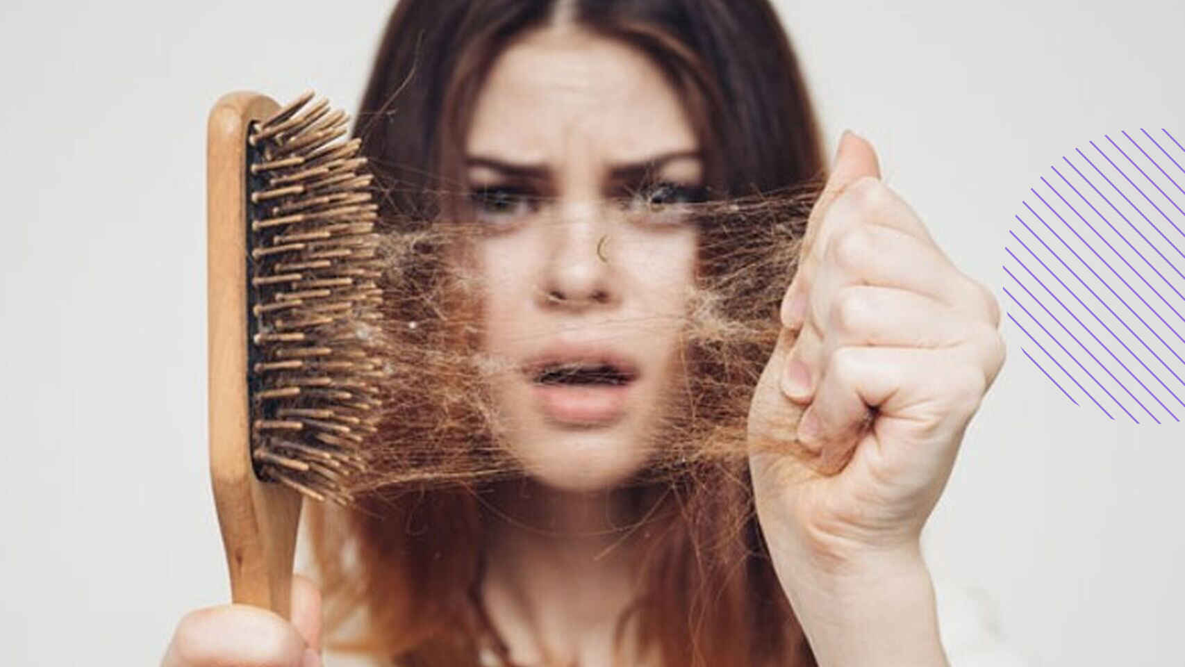 تساقط الشعر بسبب الإجهاد.. 5 طرق فعالة لمحاربة الأمر watanserb.com