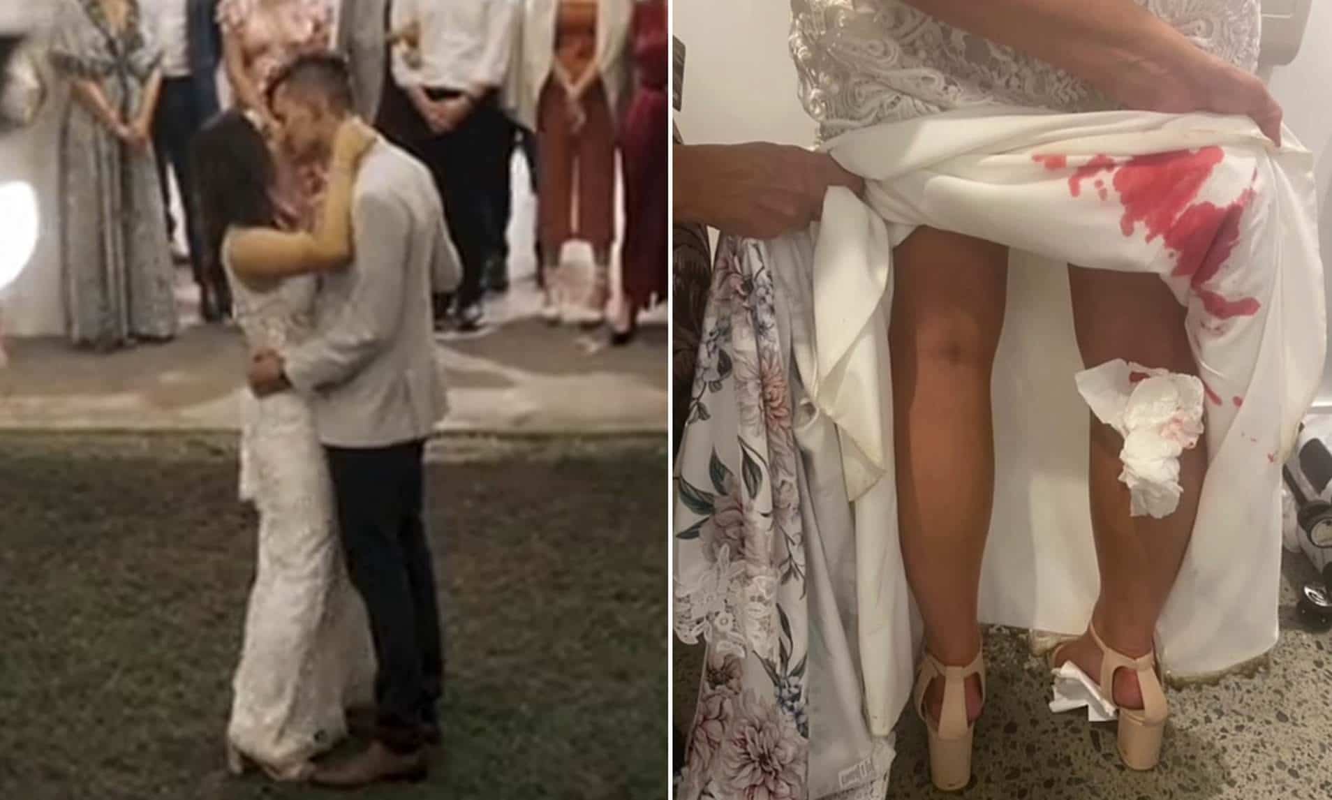 عروس في حالة صدمة بعد أن اكتشفت شيئا مرعبا تحت فستان زفافها watanserb.com