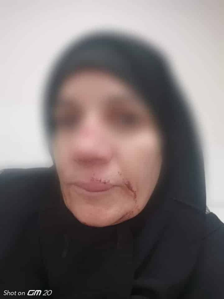 السيدة السورية اللاجئة التي تم الاعتداء عليها من مواطن تركي watanserb.com