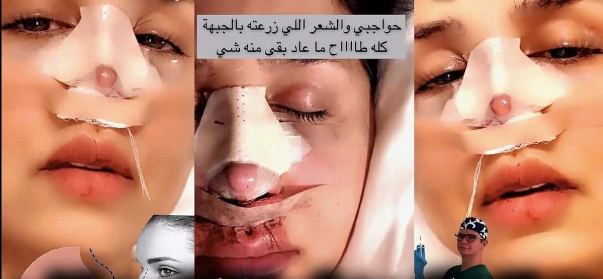 هند القحطاني تُعلن حاجتها لرجل حنون بعد ظهورها الصادم (فيديو) watanserb.com