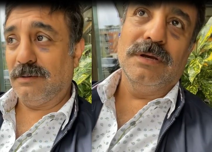 الممثل الكويتي خالد أمين يتعرض لضربة خطيرة من زميله وهذا وضعه الصحي (فيديو) watanserb.com
