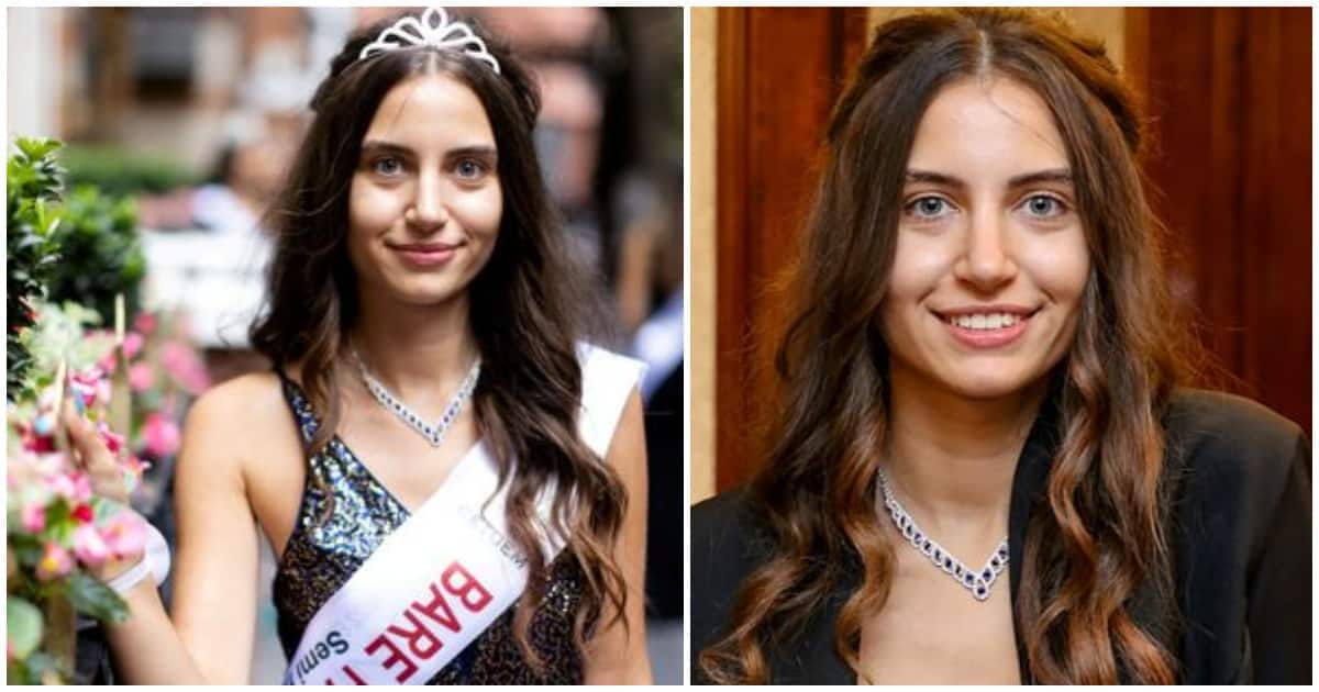 ميليسا رؤوف.. أول ملكة جمال في التاريخ بلا "مكياج" (شاهد) watanserb.com