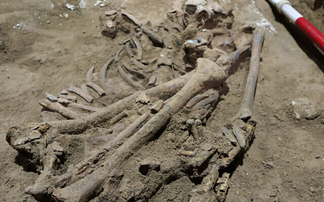 هيكل عظمي عمره 31 ألف عام يكشف عن أقدم عملية جراحية في تاريخ الطب watanserb.com