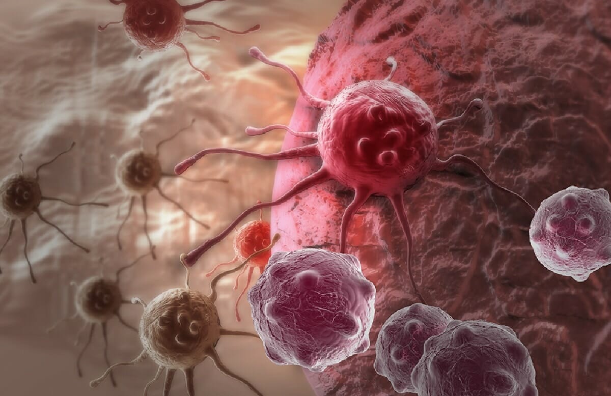  توصل باحثون من معهد الأبحاث التجريبية والسريرية بجامعة لوفان إلى اكتشاف واعد لمنع تطور نقائل سرطان الثدي