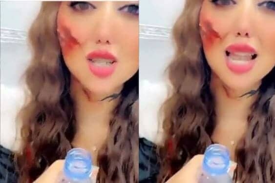 ليان عبدالله في حالة انهيار.. فيديو صادم يوثق لحظة التحرش الجماعي بها في بوليفارد الرياض! (شاهد) watanserb.com