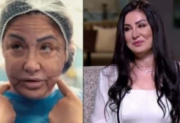 وفاء سالم.. شاهد جمالها قبل تشويه وجهها على يد طبيب تجميل بلا ضمير! watanserb.com