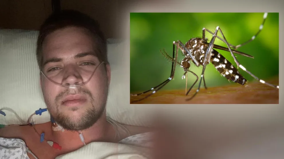 دخل في غيبوية وخضع لـ30 عملية جراحية..قصة ألماني تعرض للدغة بعوضة watanserb.com