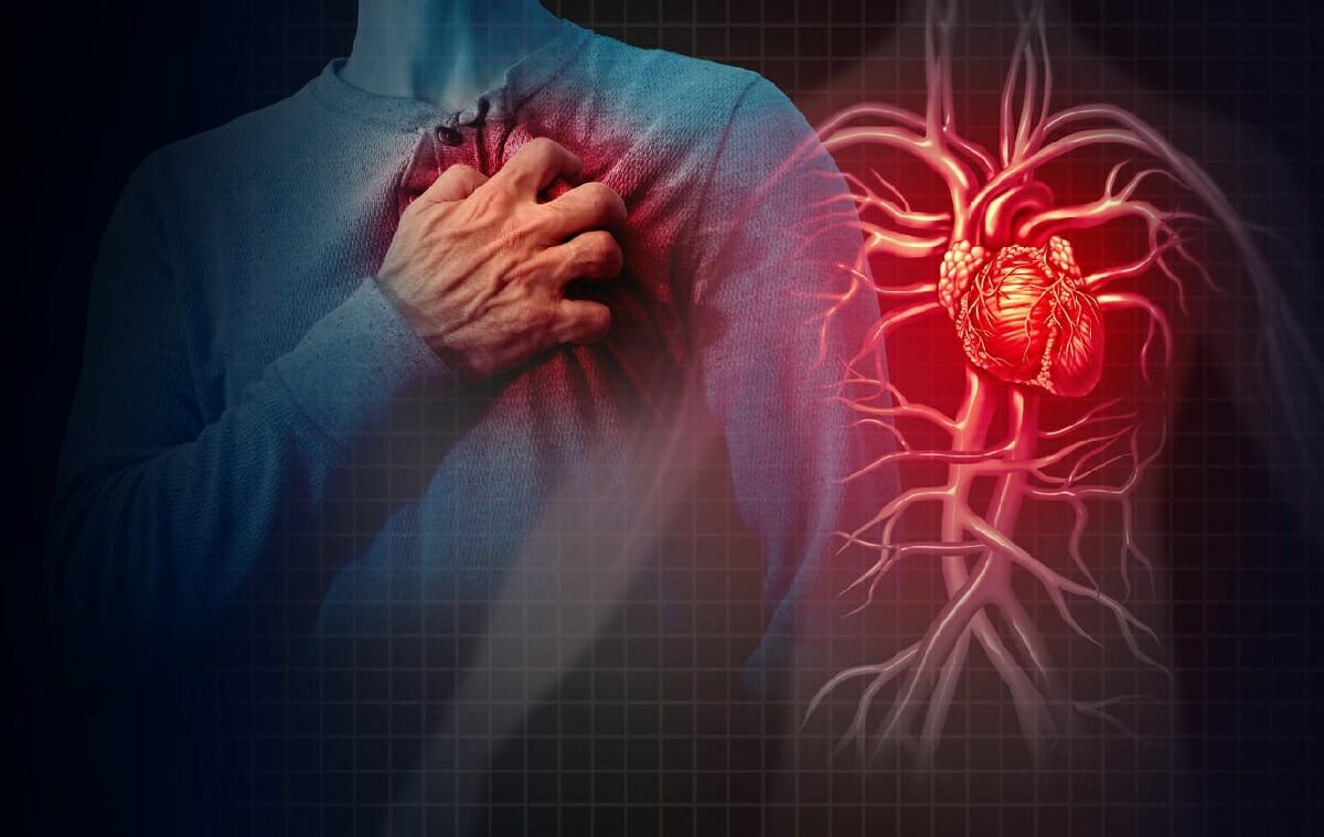 أمراض القلب والأوعية الدموية هي السبب الأول للوفاة في العالم والثاني في فرنسا