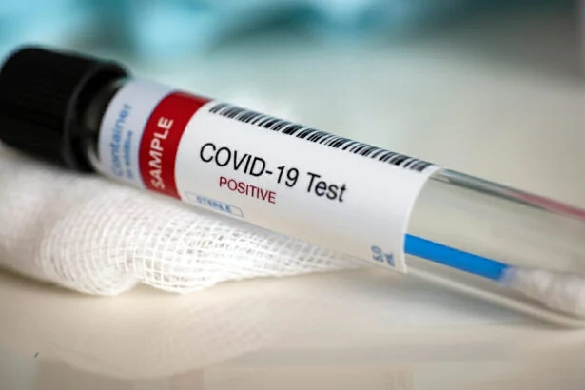 فيروس كوفيد-19