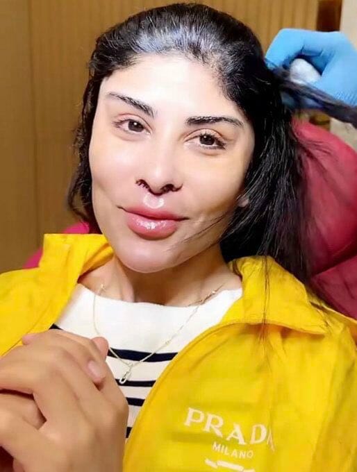 وجه الفنانة العمانية زارا البلوشي بعد عملية التجميل يصدم الجمهور! (شاهد)