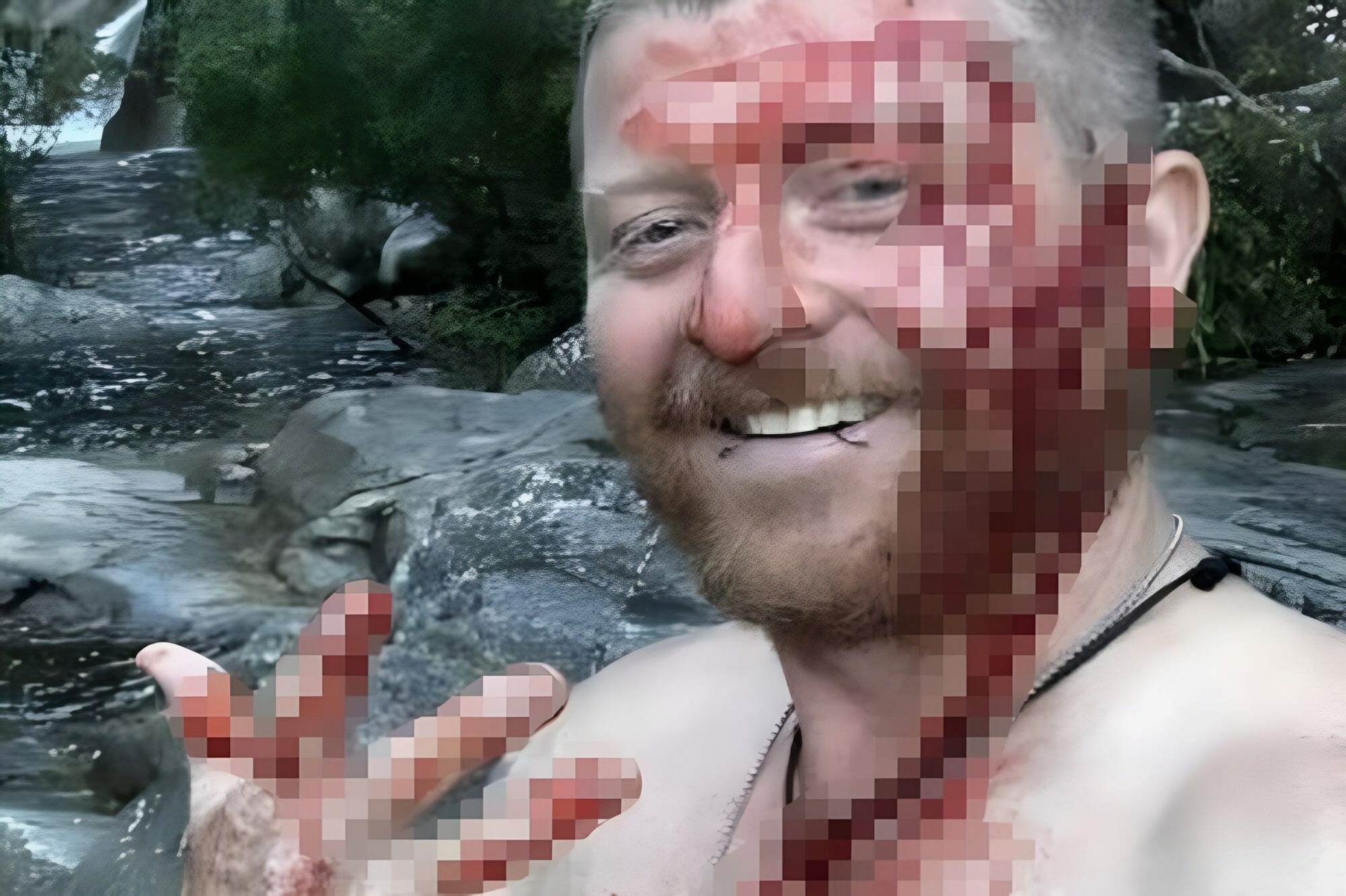 ثعبان عملاق يعض رجلاً من وجهه ويتركه في حالة مُرعبة (شاهد) watanserb.com