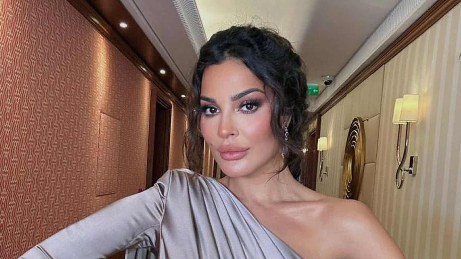 بعد خطوبتها.. نادين نجم بصورة صادمة والجروح تملأ وجهها (شاهد) watanserb.com