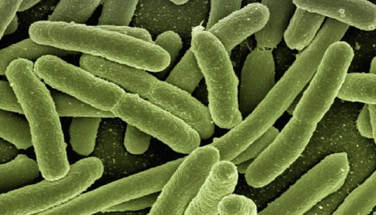 البكتيريا التي لا تستجيب للمضادات الحيوية watanserb.com