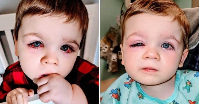 طفل يفقد بصره بسبب لعبة