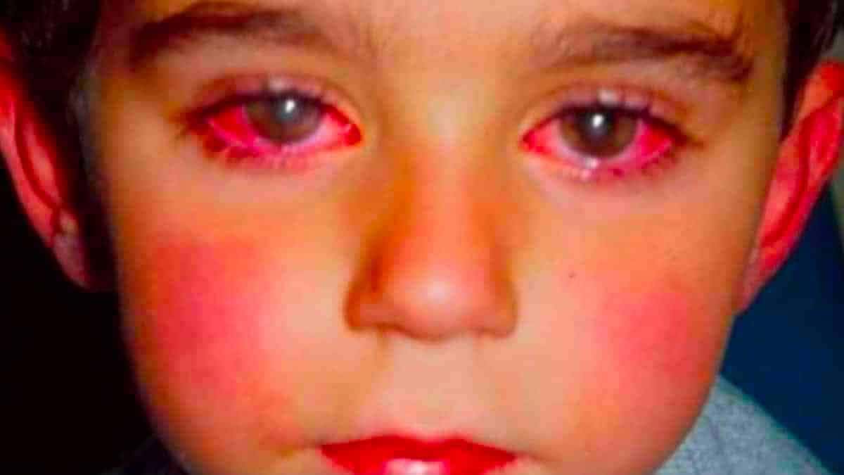 جوني مارشال