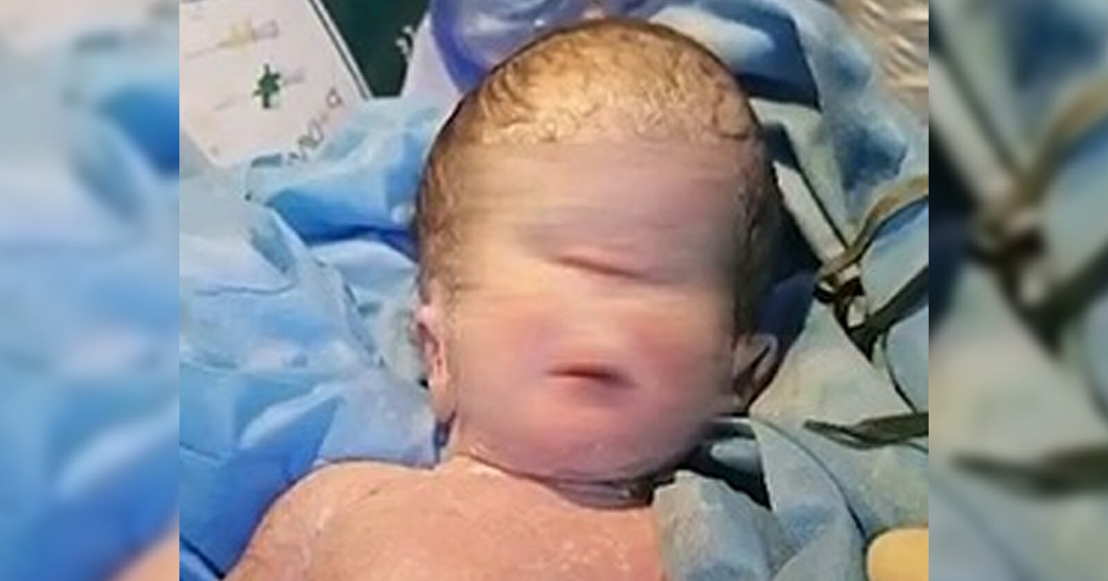 ولادة طفل بعين واحدة في العراق watanserb.com