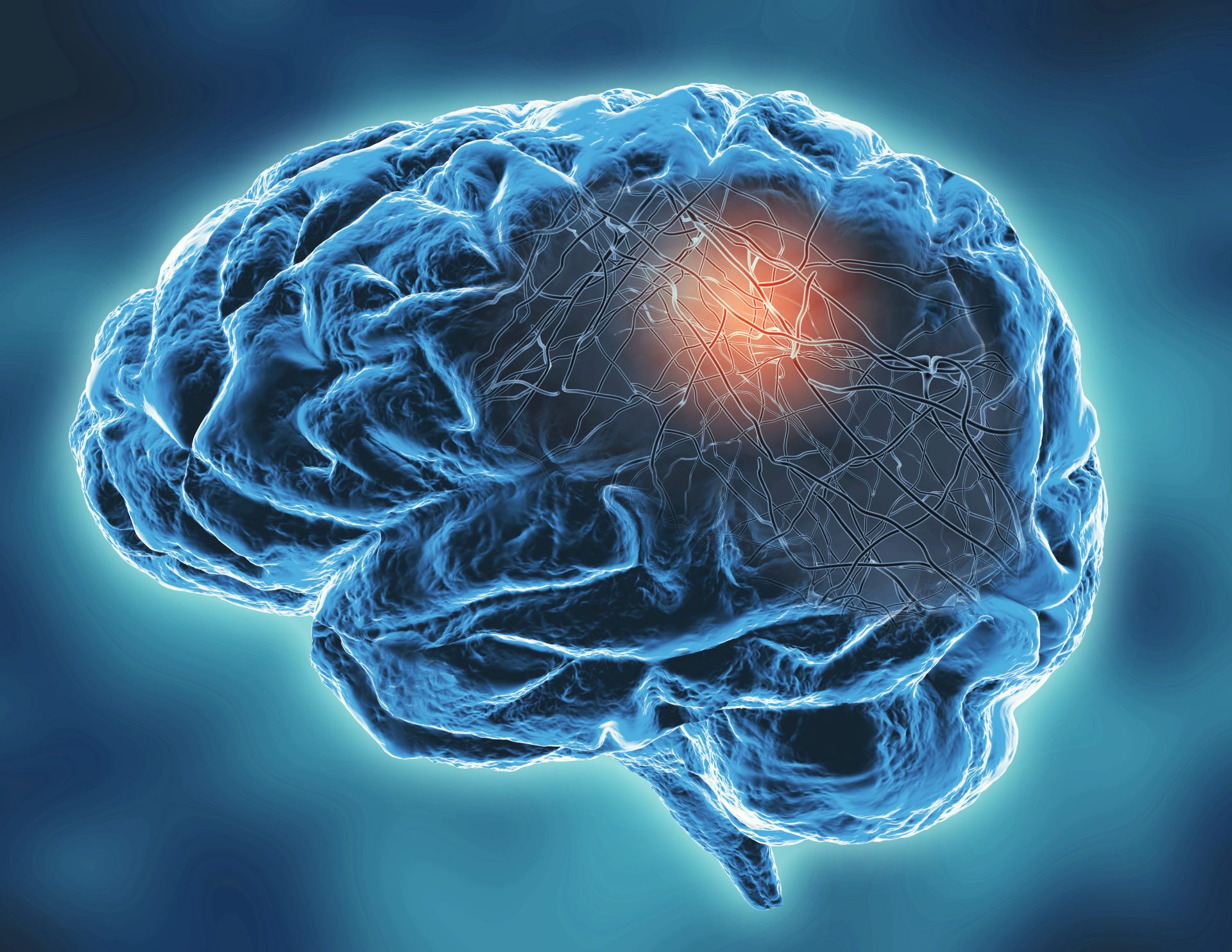 أجرى الباحثون أيضًا قياسات لنشاط دماغ الموضوعات في حالة راحة باستخدام تخطيط كهرباء المخ